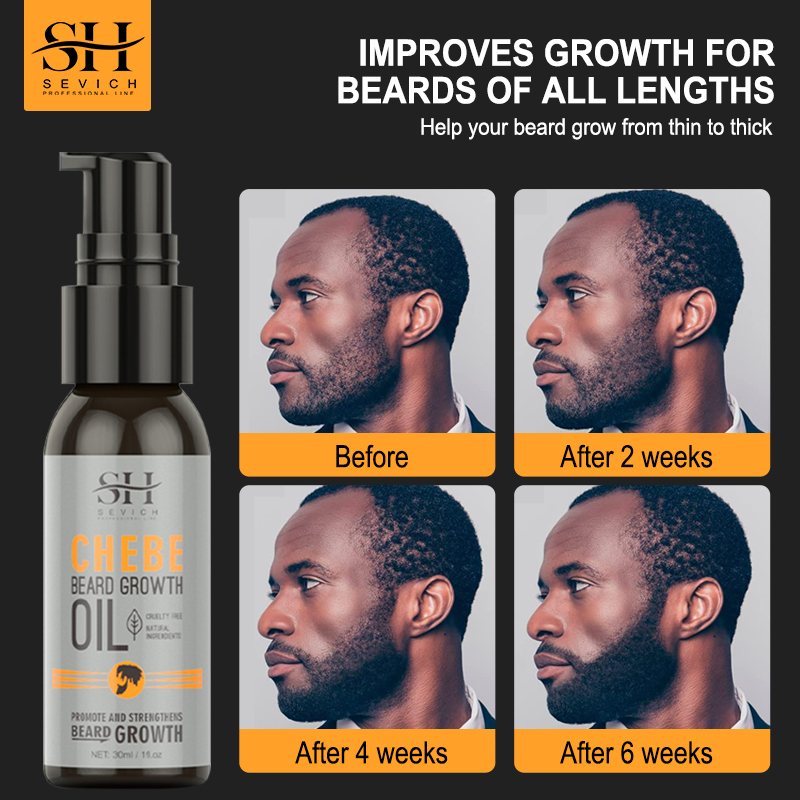 Sevich Men Beard Growth Essent – обзор и цена Beard Oil Growth