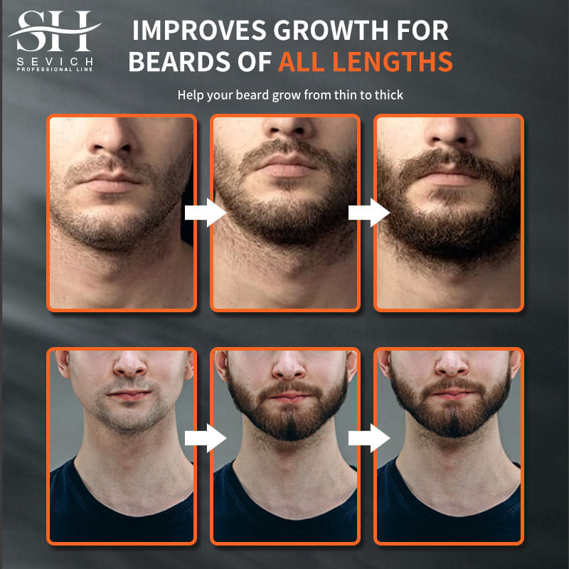 Sevich Men Beard Growth Essent – обзор и цена Beard Oil Growth