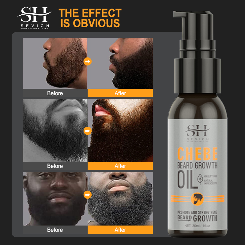 Sevich Men Beard Growth Essent – обзор и цена Beard Oil Growth