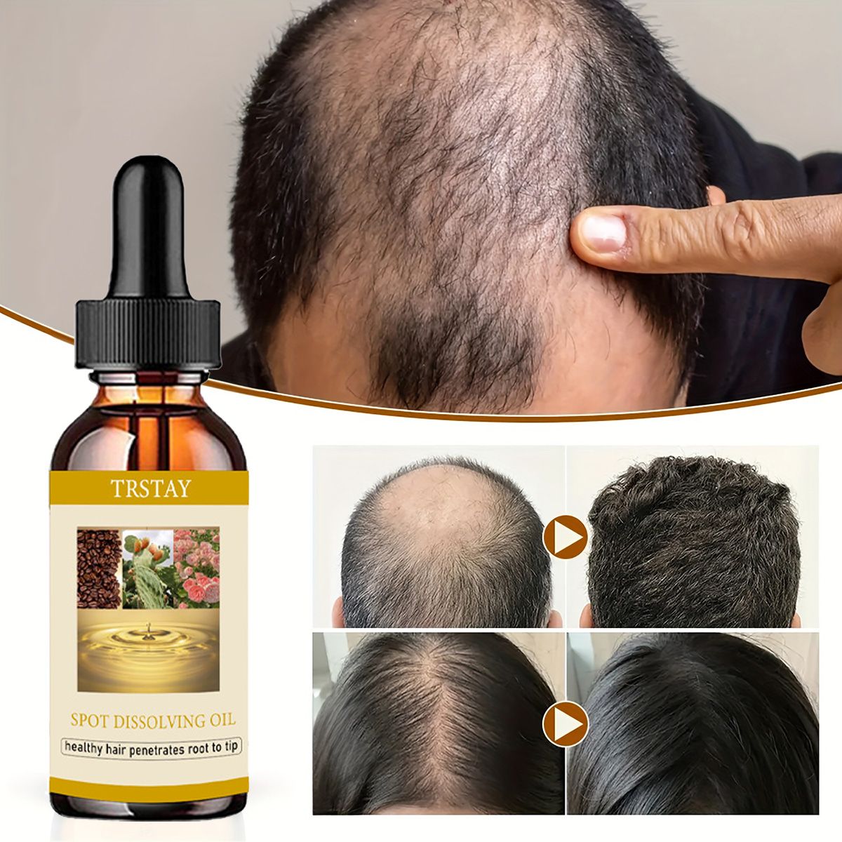 50ML Beard Growth Oil Anti Alo – обзор и цена Beard Oil Growth