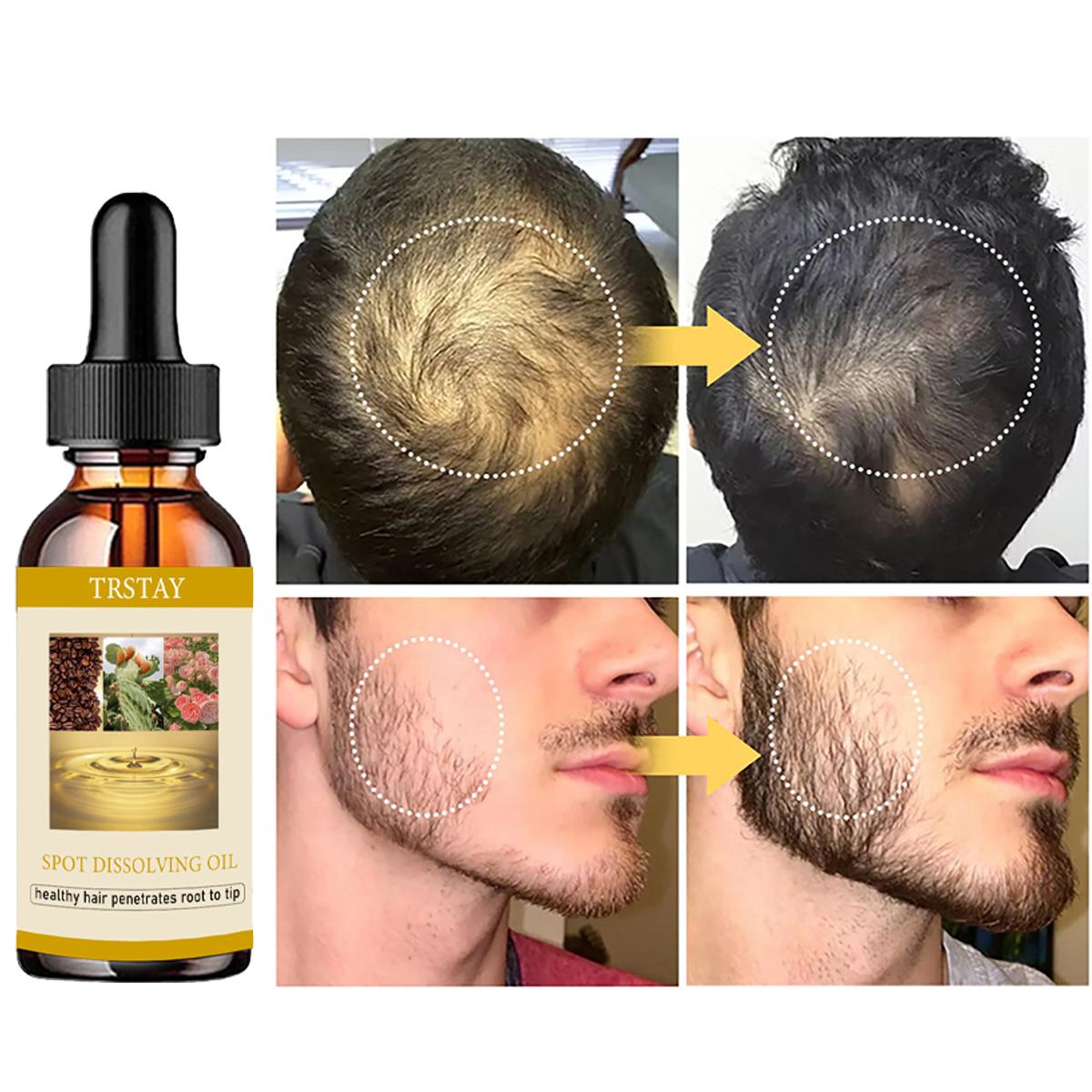 50ML Beard Growth Oil Anti Alo – обзор и цена Beard Oil Growth